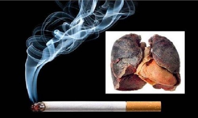 Dự thảo Thông tư cấm hút thuốc lá của Bộ Y tế: Có điểm trái Luật Giáo dục? - Ảnh minh hoạ 3